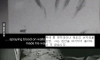 도끼질 당한 남자가 한 일 ㄷㄷ