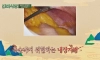 몸 속에 내장지방 차곡차곡 쌓였을때 모습..gif