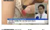 침술 ‘가짜가 아니었다’ 하버드 연구진이 인정한 한의학