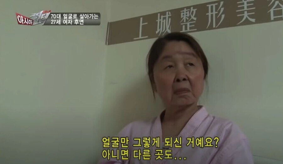 실제 나이는 20대인데 70대 얼굴로 살아가는 여자