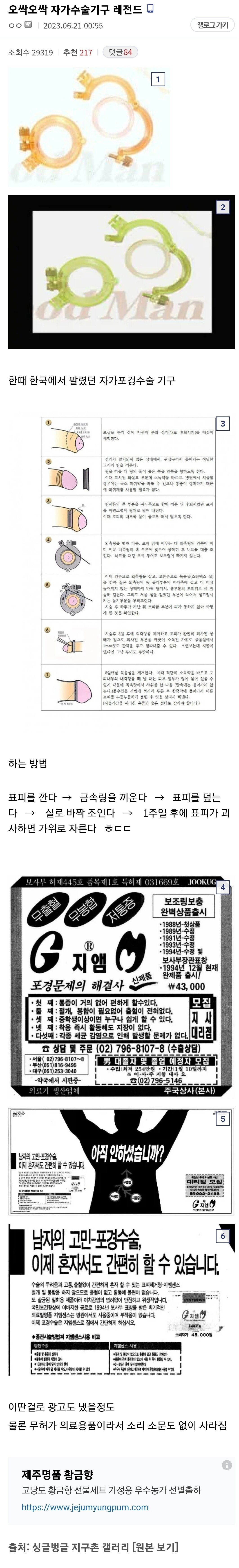 자가 포경수술 기구