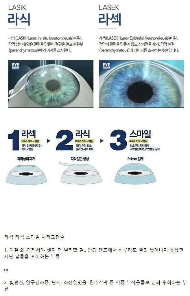 후회하는 사람이 많다는 수술