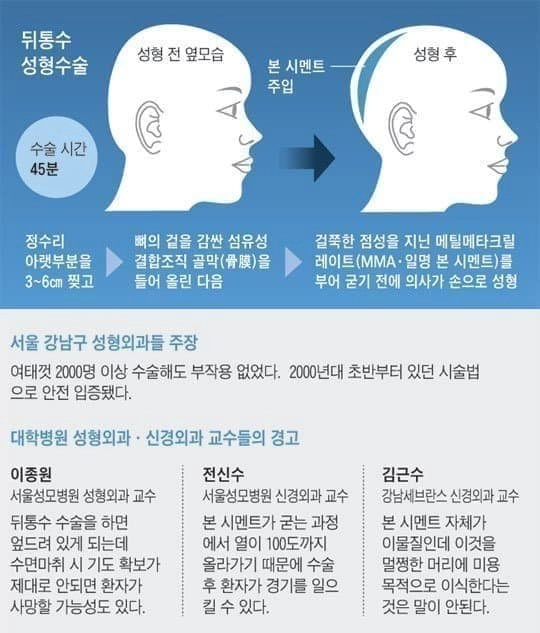 요샌 별게 다되네