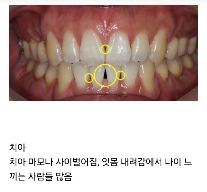 의외로 나이가 실감되는 신체부위