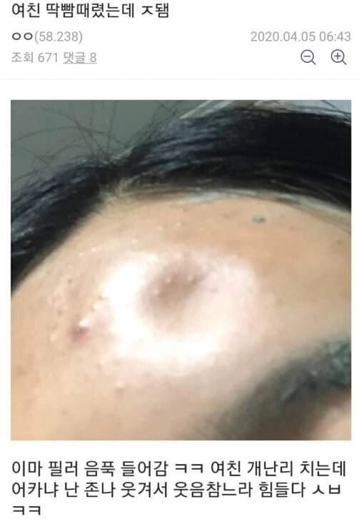 여자친구 딱밤 대참사